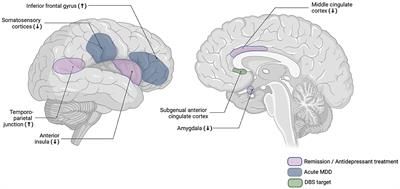 Downsides to the empathic brain? A review of neural correlates of empathy in major depressive disorder